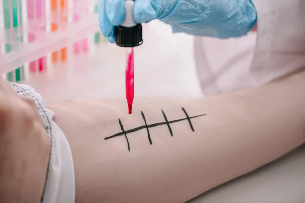 Visão recortada do médico em luva de látex segurando pipeta com líquido vermelho perto da mão masculina em laboratório — Fotografia de Stock