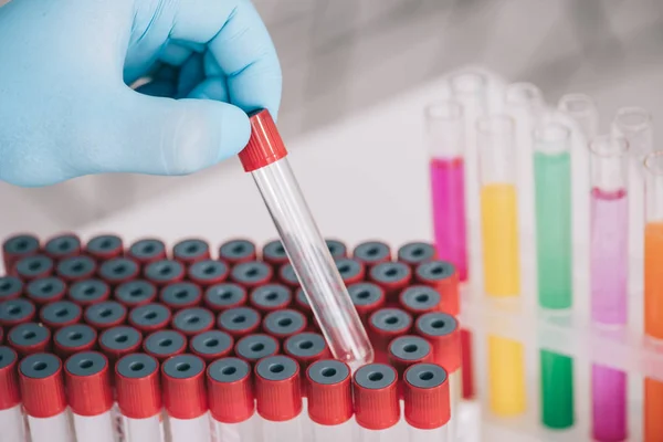 Vista recortada del médico en guante de látex sosteniendo tubo de ensayo de vidrio - foto de stock