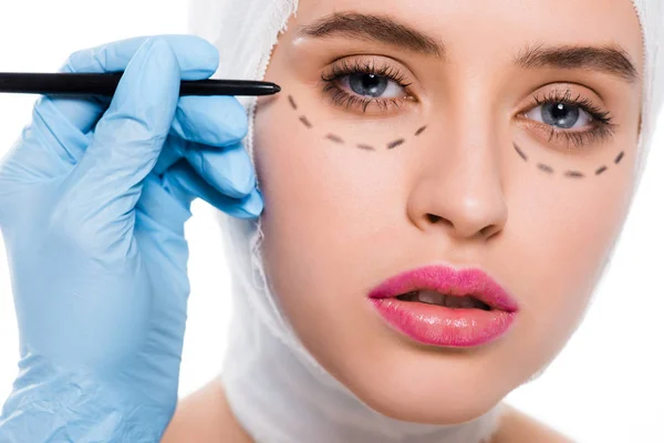 Close up of plastic surgeon in latex glove holding marker pen near woman with marks on face isolated on white — Stock Photo