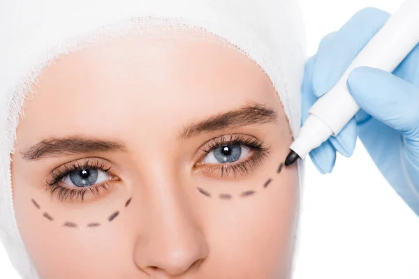 Vista ritagliata del chirurgo plastico in guanto di lattice che tiene pennarello vicino alla ragazza con segni sul viso isolato su bianco — Foto stock