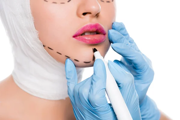 Vista recortada del cirujano plástico en guantes de látex azul que sostiene el rotulador cerca de la mujer con marcas en la cara aislada en blanco - foto de stock