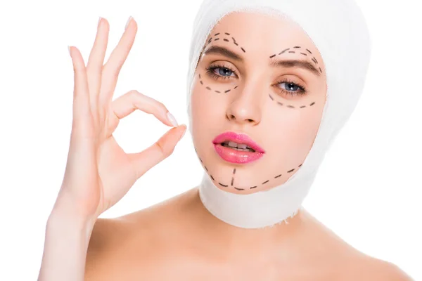 Young woman with bandaged head and marks on face showing ok sign isolated on white — Stock Photo