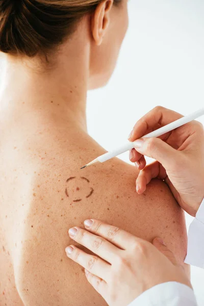 Vista recortada de dermatólogo aplicando marcas en la piel de mujer desnuda con lápiz aislado en blanco - foto de stock