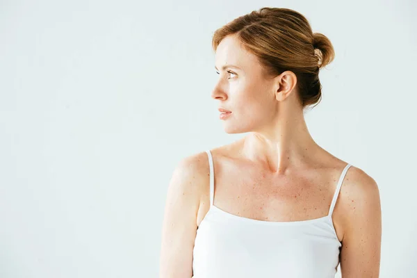 Jolie femme avec mélanome debout isolé sur blanc — Photo de stock