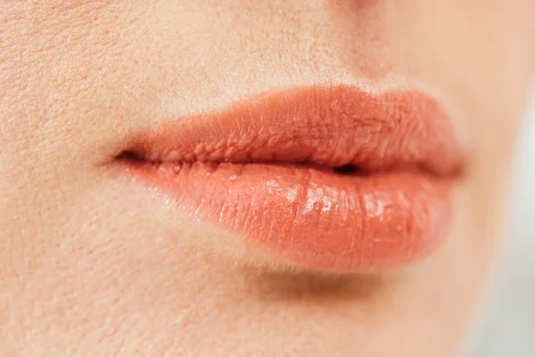 Cropped view of herpes on lips of diseased woman — Stock Photo