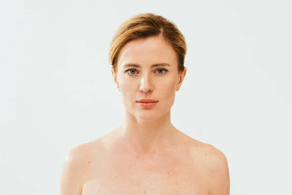 Голая больная женщина с кожной болезнью смотрит в камеру на белом — стоковое фото