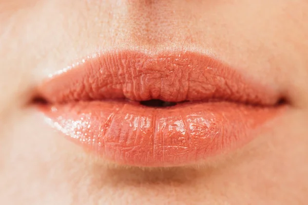 Primer plano del herpes en los labios de la mujer enferma - foto de stock