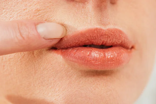 Cropped view of sick woman touching herpes on lips — Stock Photo