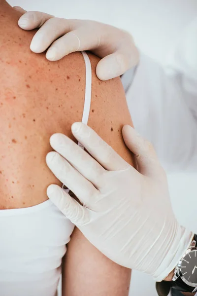 Vista recortada de dermatólogo en guantes de látex blanco examinando mujer con enfermedad de la piel aislada en blanco - foto de stock