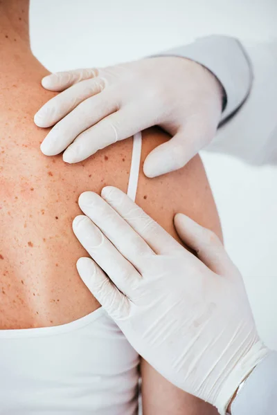 Vista recortada de dermatólogo en guantes de látex examinando mujer con melanoma en la espalda aislado en blanco - foto de stock