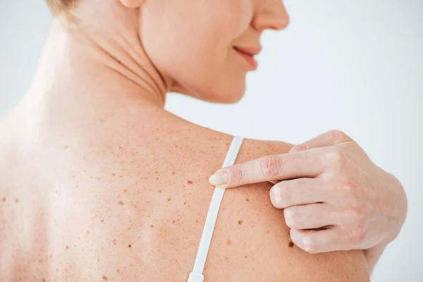 Vista ritagliata di donna sorridente che punta con il dito al neo sul bianco — Foto stock