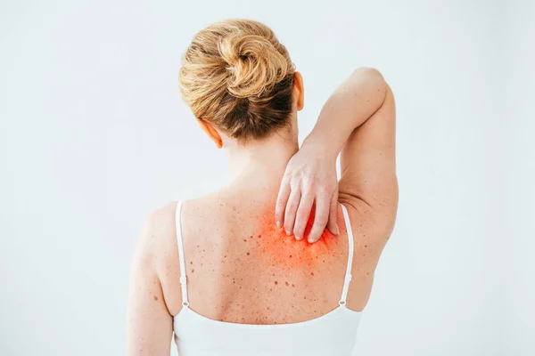 Abgeschnittene Ansicht einer kranken Frau mit Allergie, die rote Haut auf weißer isoliert kratzt — Stockfoto