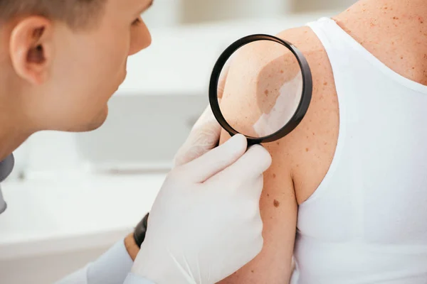 Dermatólogo en guantes de látex sosteniendo lupa mientras examina paciente con enfermedad de la piel - foto de stock