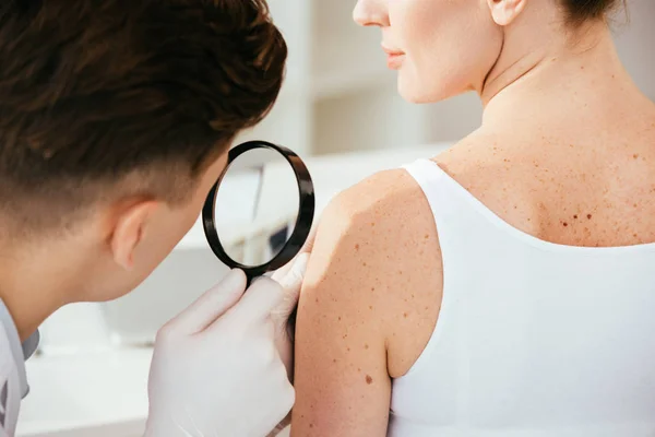 Visão cortada de dermatologista segurando lupa enquanto examina paciente com doença de pele — Fotografia de Stock