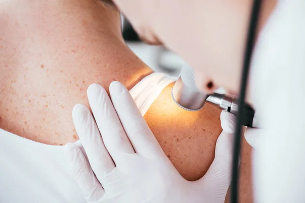 Vista recortada del dermatólogo que sostiene el dermatoscopio mientras examina a una mujer con melanoma - foto de stock