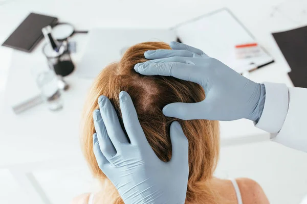 Vista aérea del dermatólogo en guantes de látex azul examinando el pelo del paciente en la clínica - foto de stock