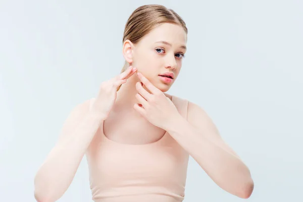 Displeased teenage girl having acne on cheek isolated on grey — Stock Photo