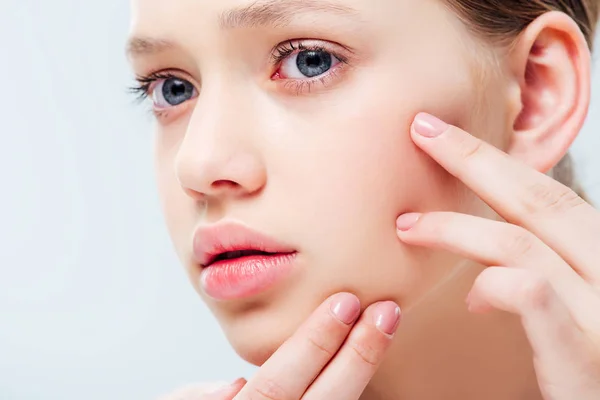 Vista da vicino della ragazza adolescente scontenta di avere l'acne sul viso isolato sul grigio — Foto stock