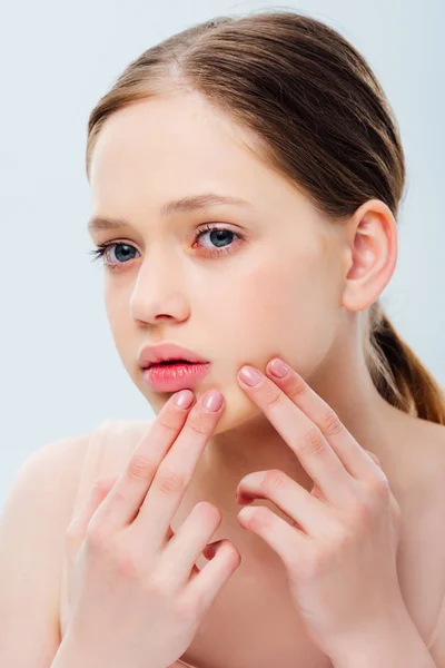Aufgebrachte Teenager-Mädchen mit Akne berühren Gesicht isoliert auf grau — Stockfoto