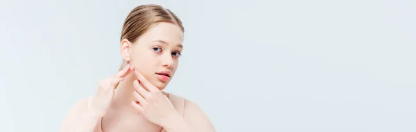 Upset teenage girl touching pimple on face, panoramic shot — Stock Photo