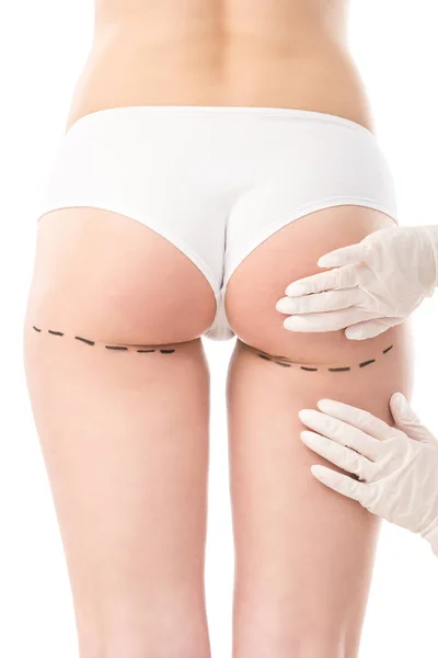 Cropped view of plastic surgeon in latex gloves and patient in panties with marks on body isolated on white — Stock Photo