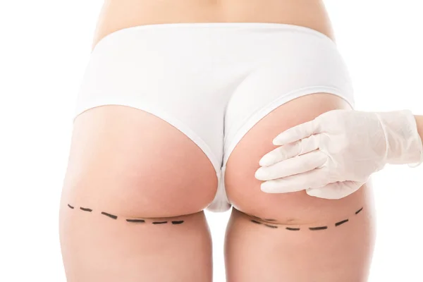 Cropped view of plastic surgeon in latex glove and patient in panties with marks on body isolated on white — Stock Photo