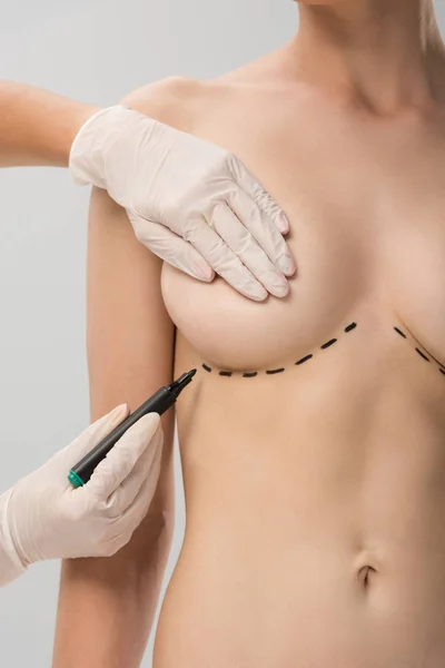 Cropped view of plastic surgeon in latex gloves making marks on breast isolated on grey — Stock Photo