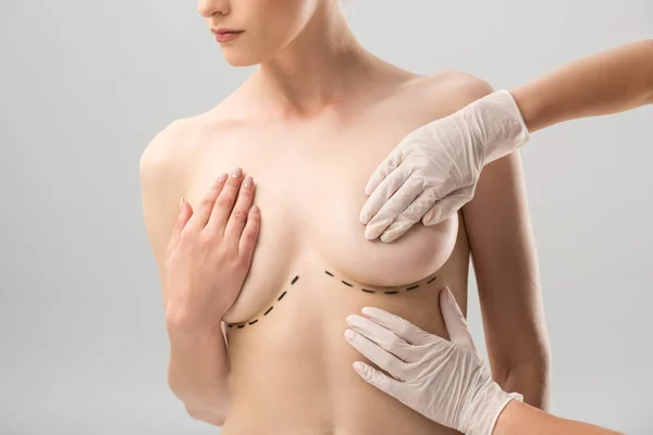 Visão parcial do cirurgião plástico em luvas de látex e paciente com marcas sob mama isolada em cinza — Fotografia de Stock