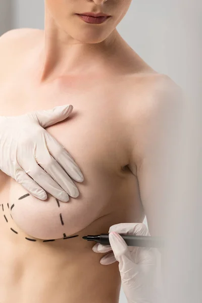 Cropped view of plastic surgeon in latex gloves making marks on breast isolated on grey — Stock Photo