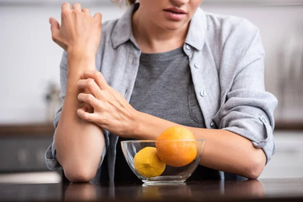 Vista recortada de la mujer rascándose la mano cerca de tazón de vidrio con frutas - foto de stock