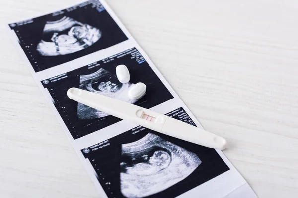 Pills and pregnancy test on ultrasound image — Stock Photo