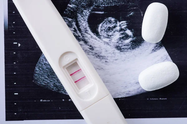 Primer plano de las píldoras y prueba de embarazo en la imagen de ultrasonido - foto de stock