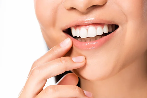 Visão parcial de bela mulher asiática mostrando dentes brancos isolados no branco — Fotografia de Stock