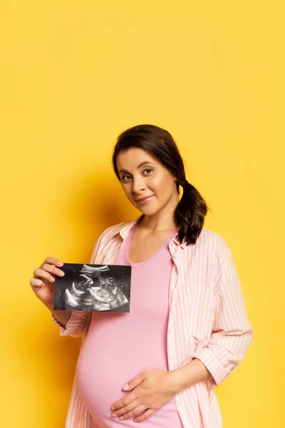 Pregnant woman showing ultrasound scan while touching tummy on yellow — Stock Photo