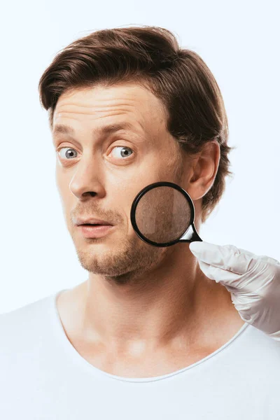 Dermatologista em luva de látex segurando lupa quase chocado paciente isolado em branco — Fotografia de Stock