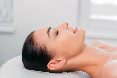 akupunktur tedavisi spa salonu sahip kadın yan görünüm