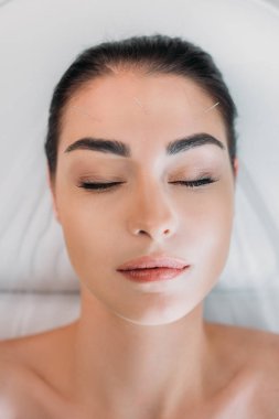 kadının spa salonda akupunktur tedavisi yaparken rahatlatıcı havai görünümü