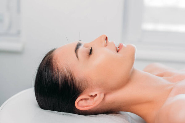 side view of woman having acupuncture therapy in spa salon
