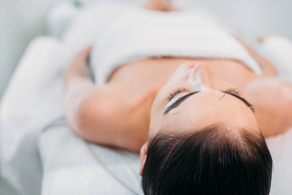 woman with needles on face having acupuncture therapy in spa salon