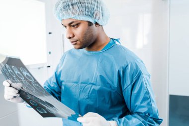 Tıbbi kap ve Latex eldiven tutarak ve x-ray bakıyor yakışıklı Doktor 