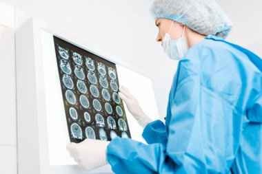 Doktor üniforma ve tıbbi eldiven Holding x-ray klinikte 