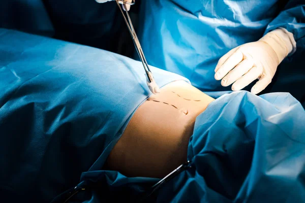 Visão Cortada Cirurgião Fazendo Operação Com Equipamento Médico — Fotografia de Stock