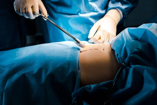 Bijgesneden Weergave Van Chirurg Doen Werking Het Vasthouden Van Tampon — Stockfoto