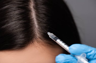 close up view of brunette woman having scalp mesotherapy isolated on black clipart