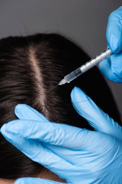 close up view of brunette woman having scalp mesotherapy isolated on black clipart