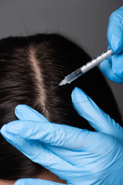 Close View Brunette Woman Having Scalp Mesotherapy Isolated Black — Stock Photo, Image
