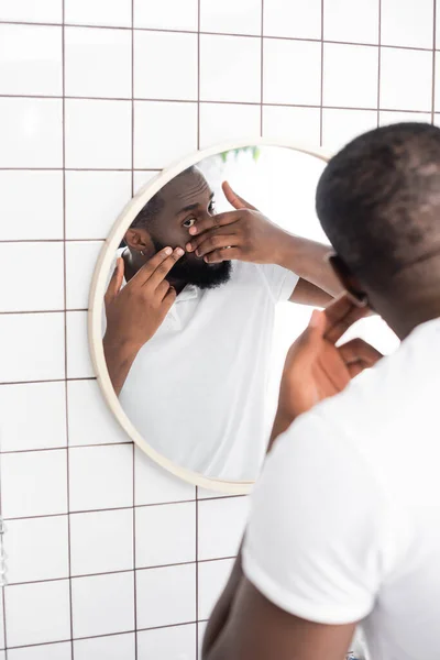 Hombre Afro Americano Tratando Apretar Espinilla —  Fotos de Stock