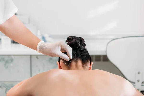 Inyección recortada de cosmetólogo poner agujas en el cuerpo de las mujeres durante la terapia de acupuntura en el salón de spa - foto de stock