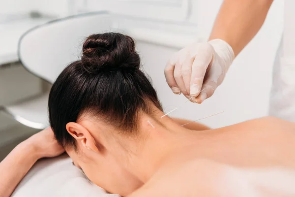 Schnappschuss von Kosmetikerin, die bei Akupunkturtherapie im Wellness-Salon Nadeln auf Frauenkörper legt — Stockfoto