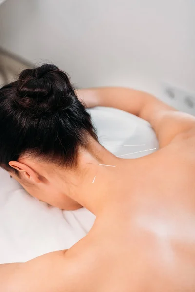 Vista parcial de la mujer que tiene terapia de acupuntura en el salón de spa - foto de stock